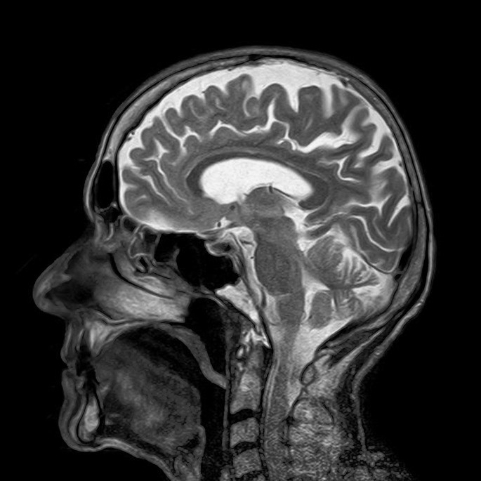 cerebro organos del cuerpo humano
